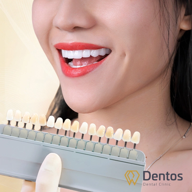 Răng sứ Lava Esthetic có màu sắc sống động y như răng thật